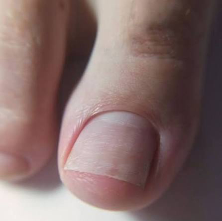 Педикюр только пальчиков без покрытия