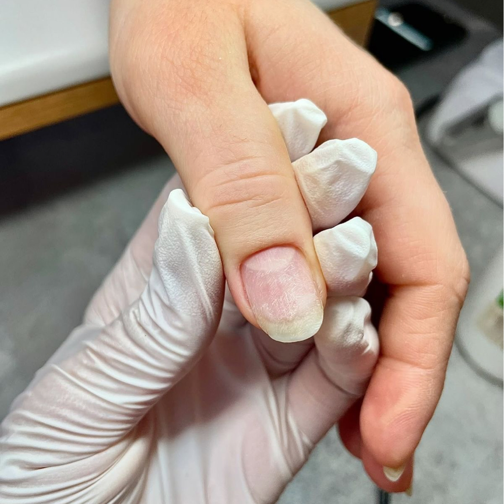 Снятие старого материала