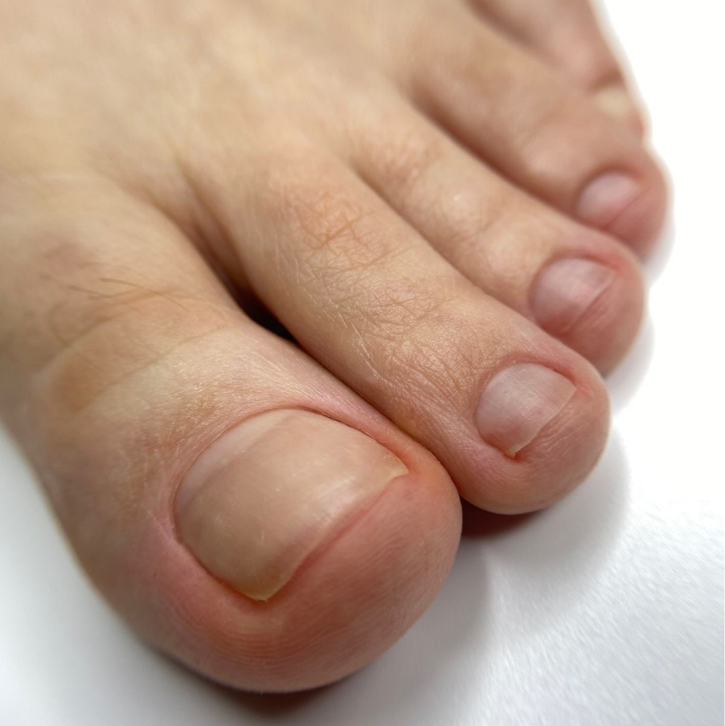 Мужской педикюр