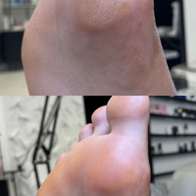 Smart педикюр (без покрытия)