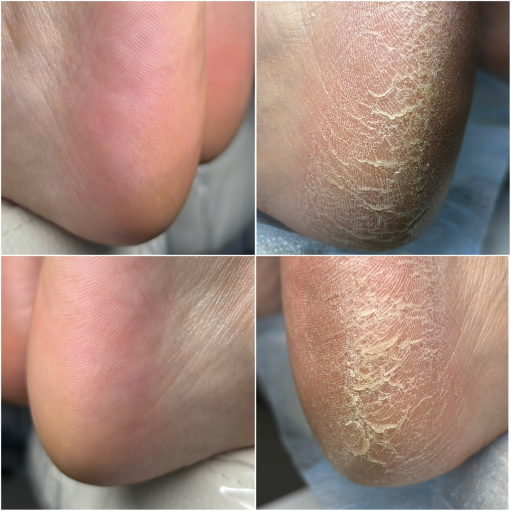 Педикюр(обработка пальчиков и стоп)