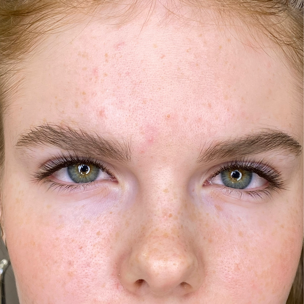 Классическое наращивание