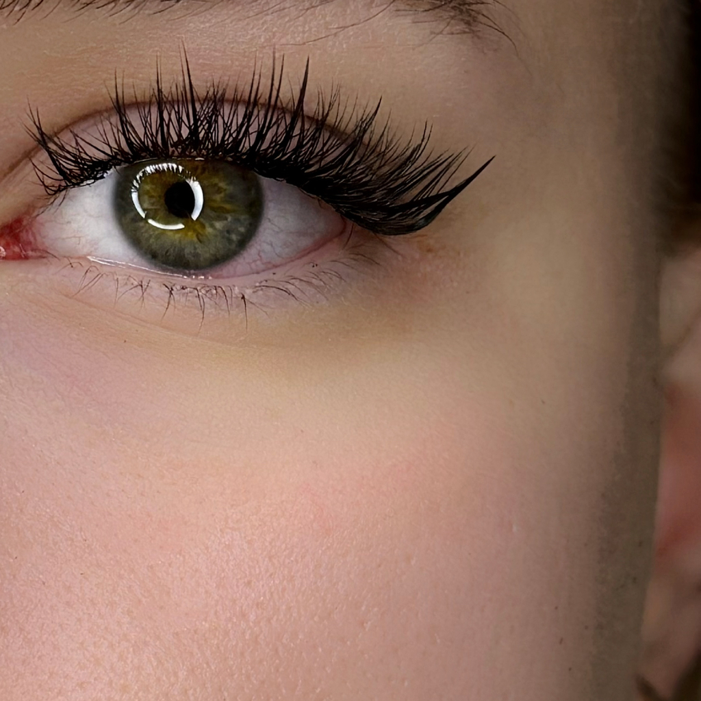 Добавление лучей