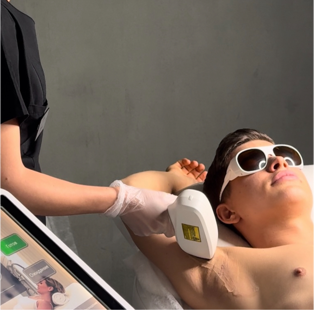 Зона над верхней/нижней губой | Подбородок муж