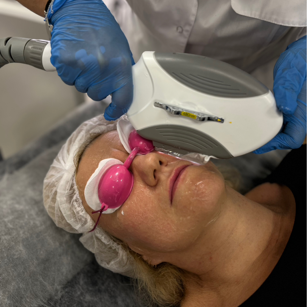 Удаление сосудов