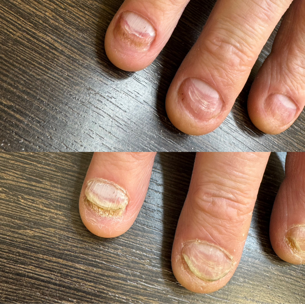 Маникюр подология