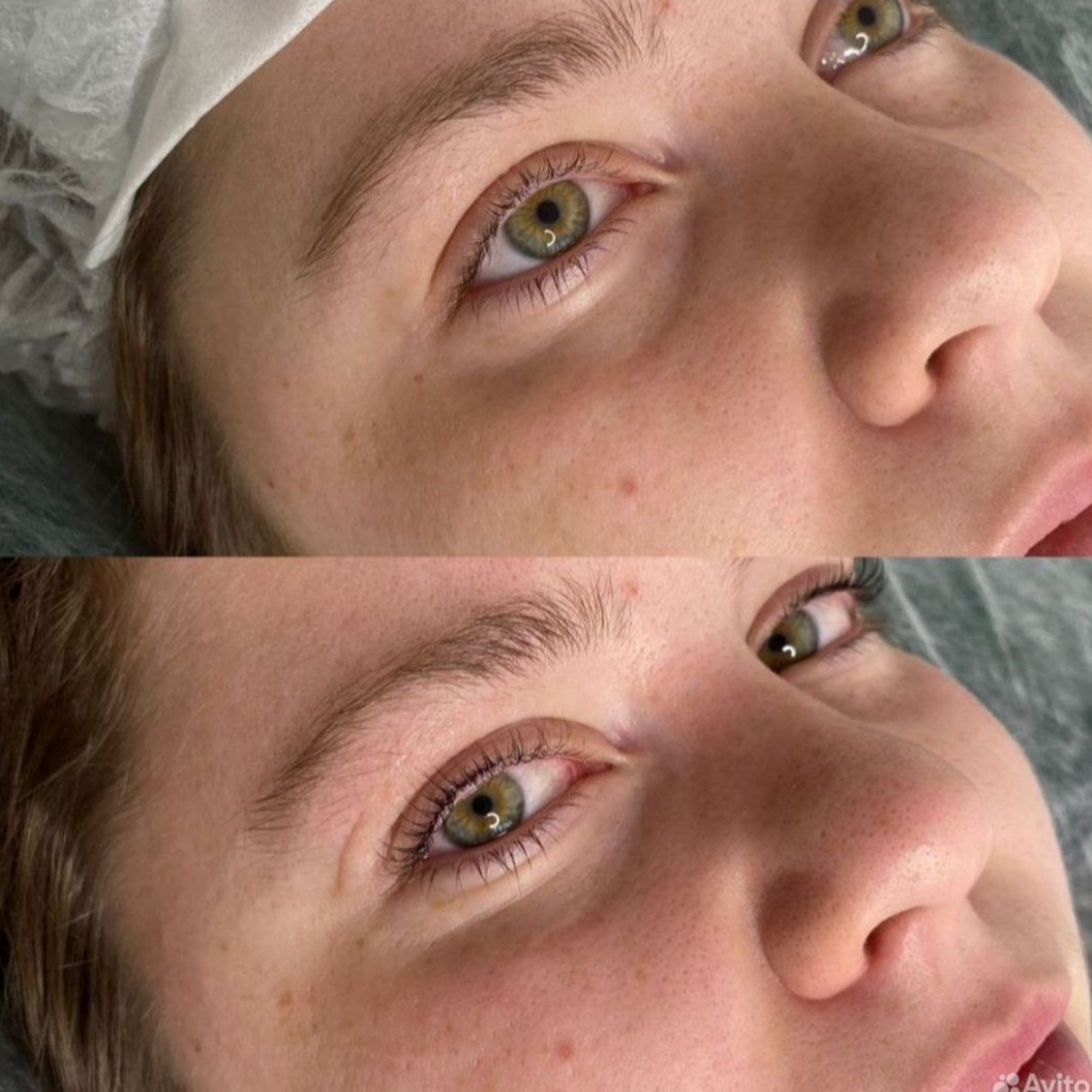 Ламинирование ресниц