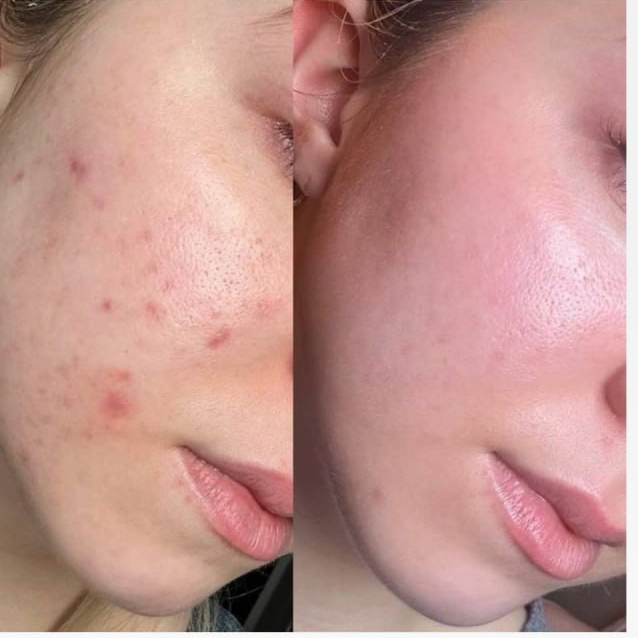 Чистка лица в 8 этапов