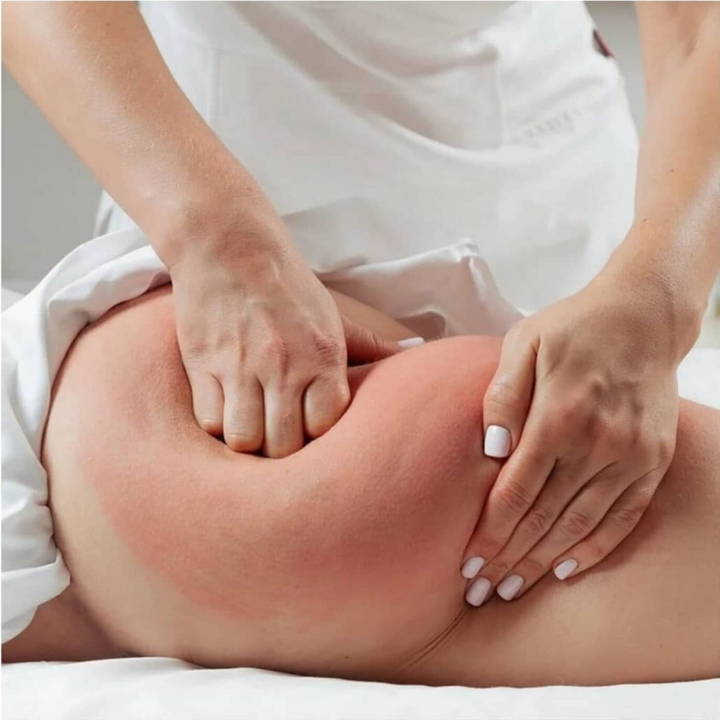 Антицеллюлитный массаж, 30 мин. (1 сеанс)