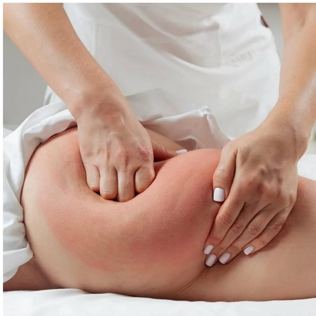 Абонемент: Антицеллюлитный массаж, 60 мин. (5 сеансов)