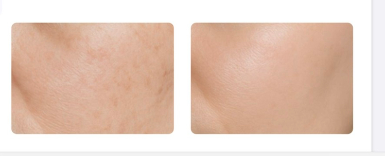 Белоснежка