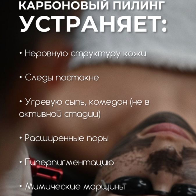 Карбоновый пилинг