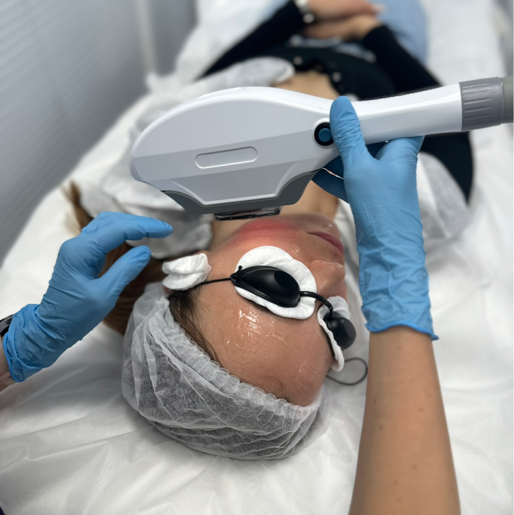 Фотоомоложение лица