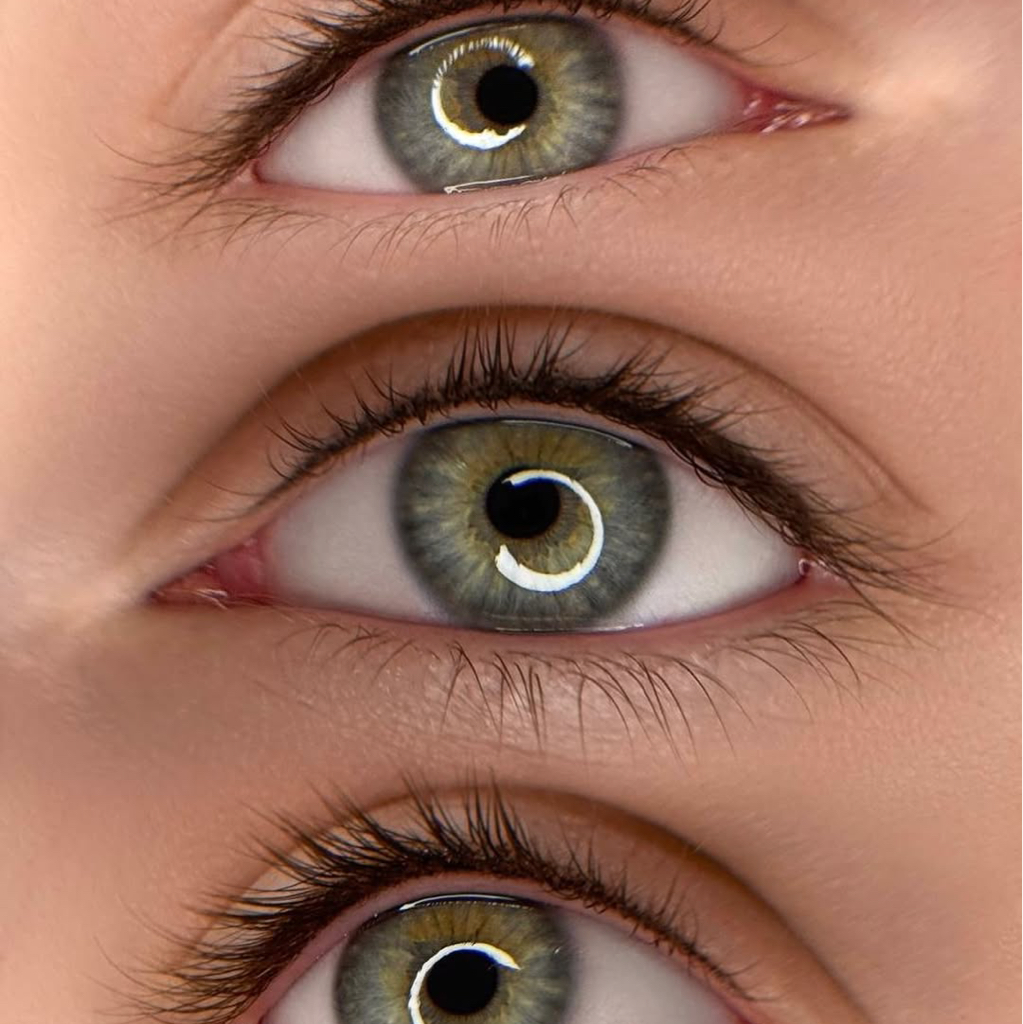 Межресничка