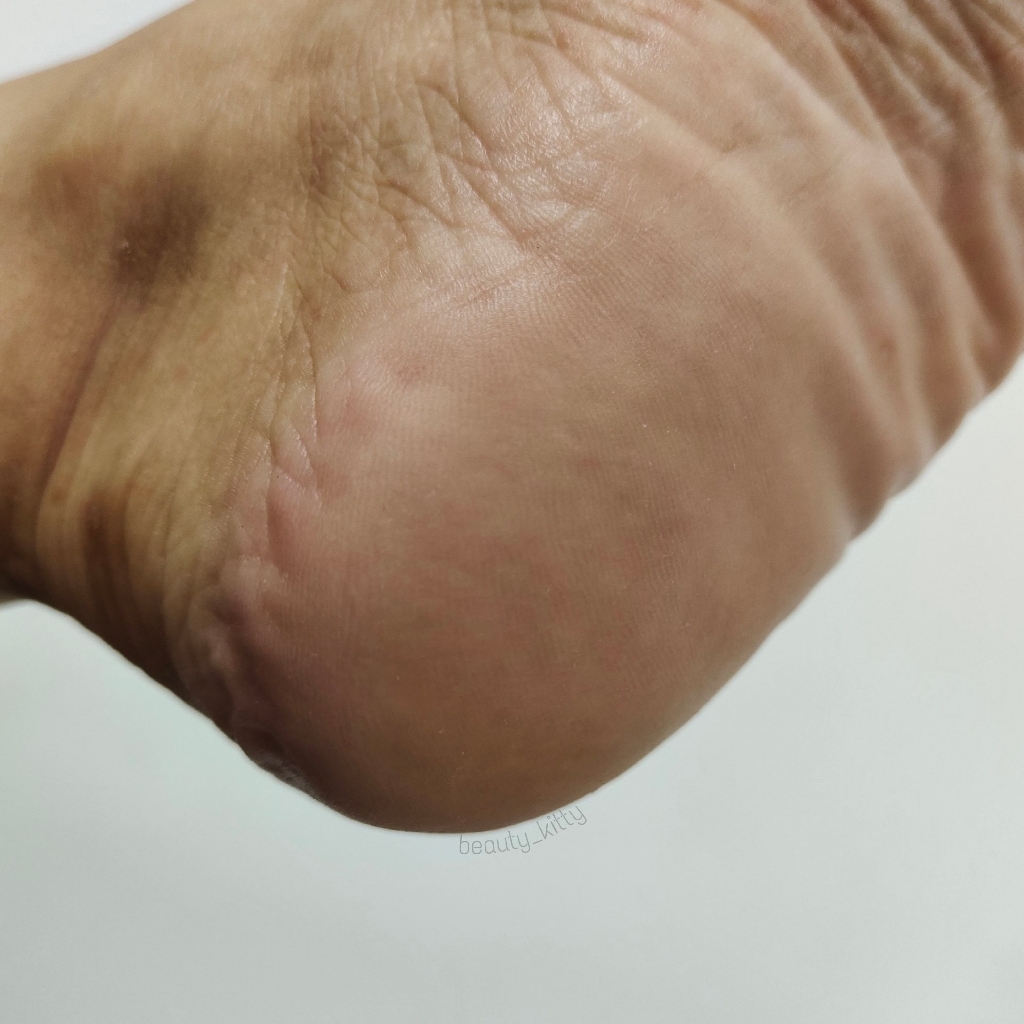 Обработка стоп