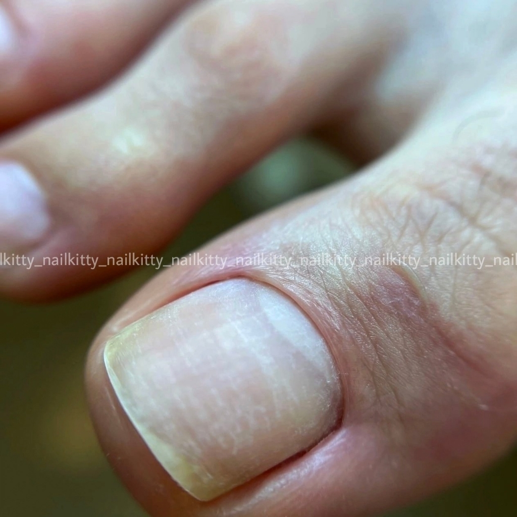 Полный комплекс без покрытия