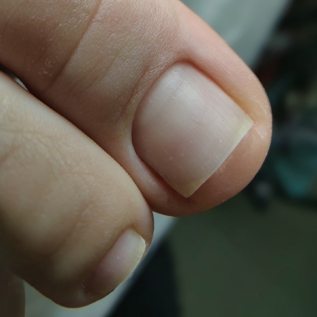 Комплекс мини