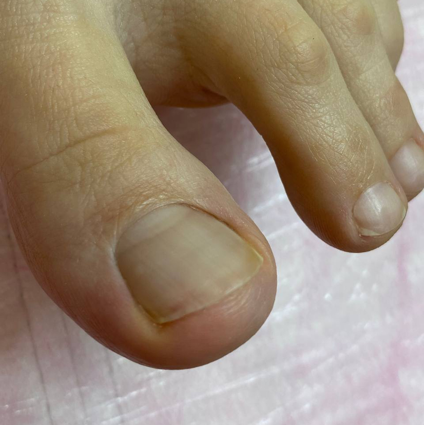 Обработка кутикулы, валиков и стопы