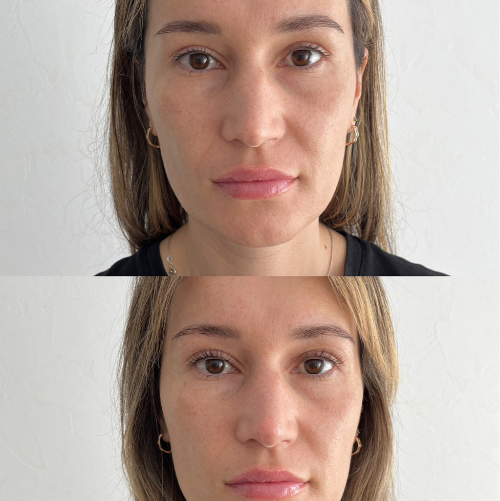 Итальянское восстановление ресниц