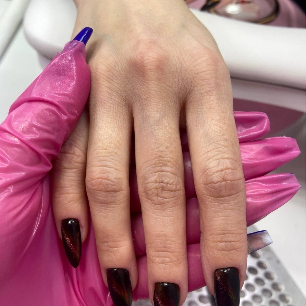 Парафинотерапия