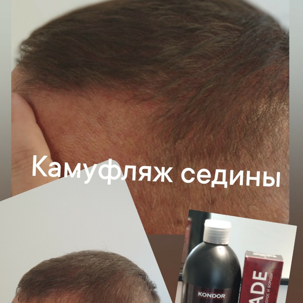 Камуфляж седины