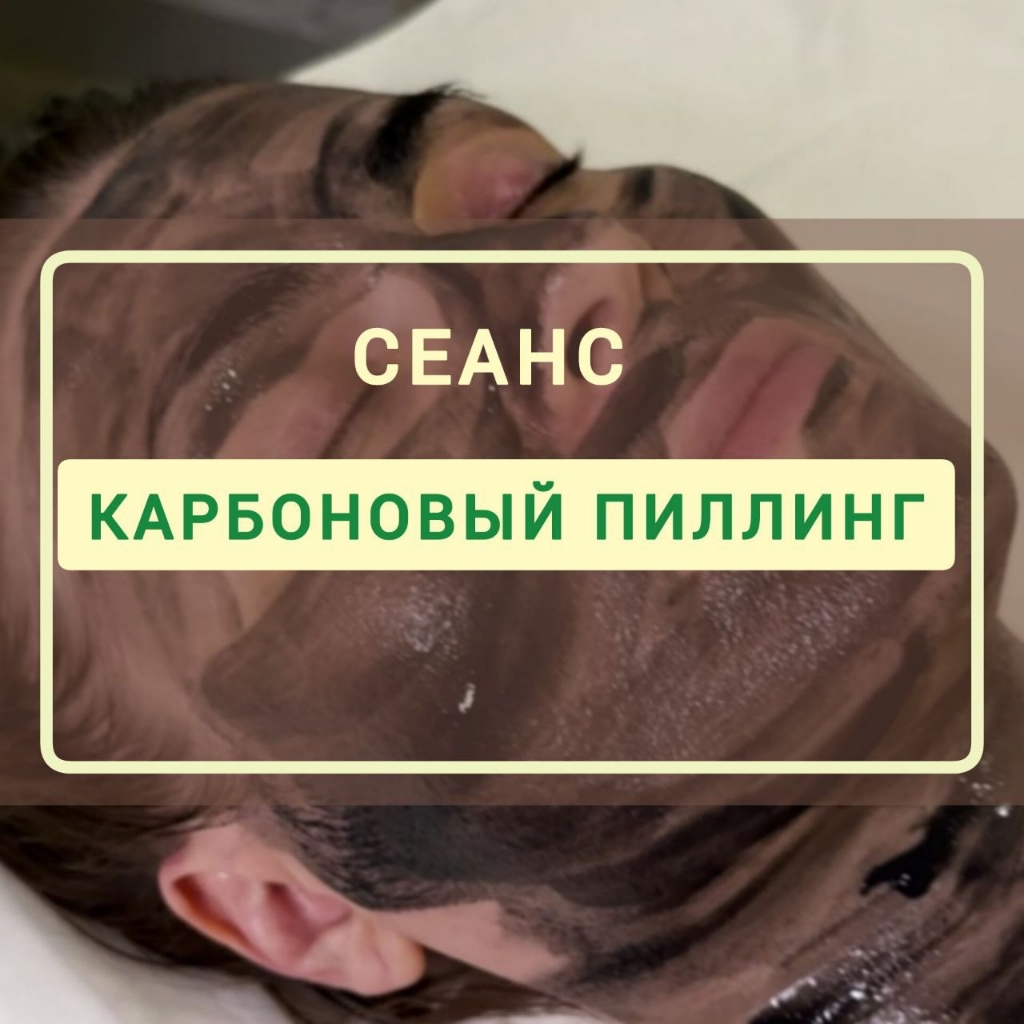 Карбоновый пилинг