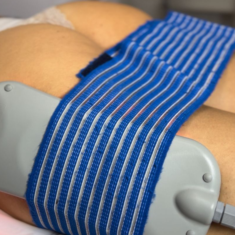 Липолазер STS