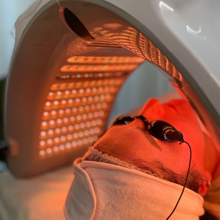 ФОТОТЕРАПИЯ Led (по желанию УЗ-чистка)