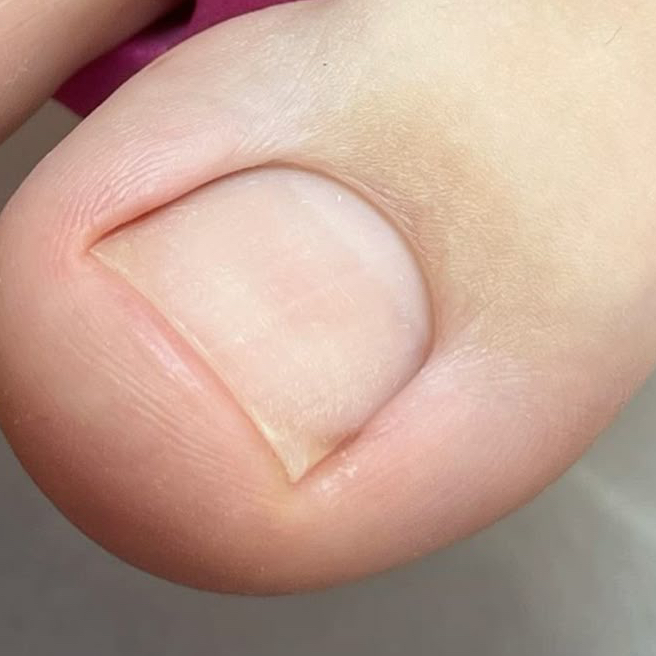 Педикюр без покрытия и без обработки стопы