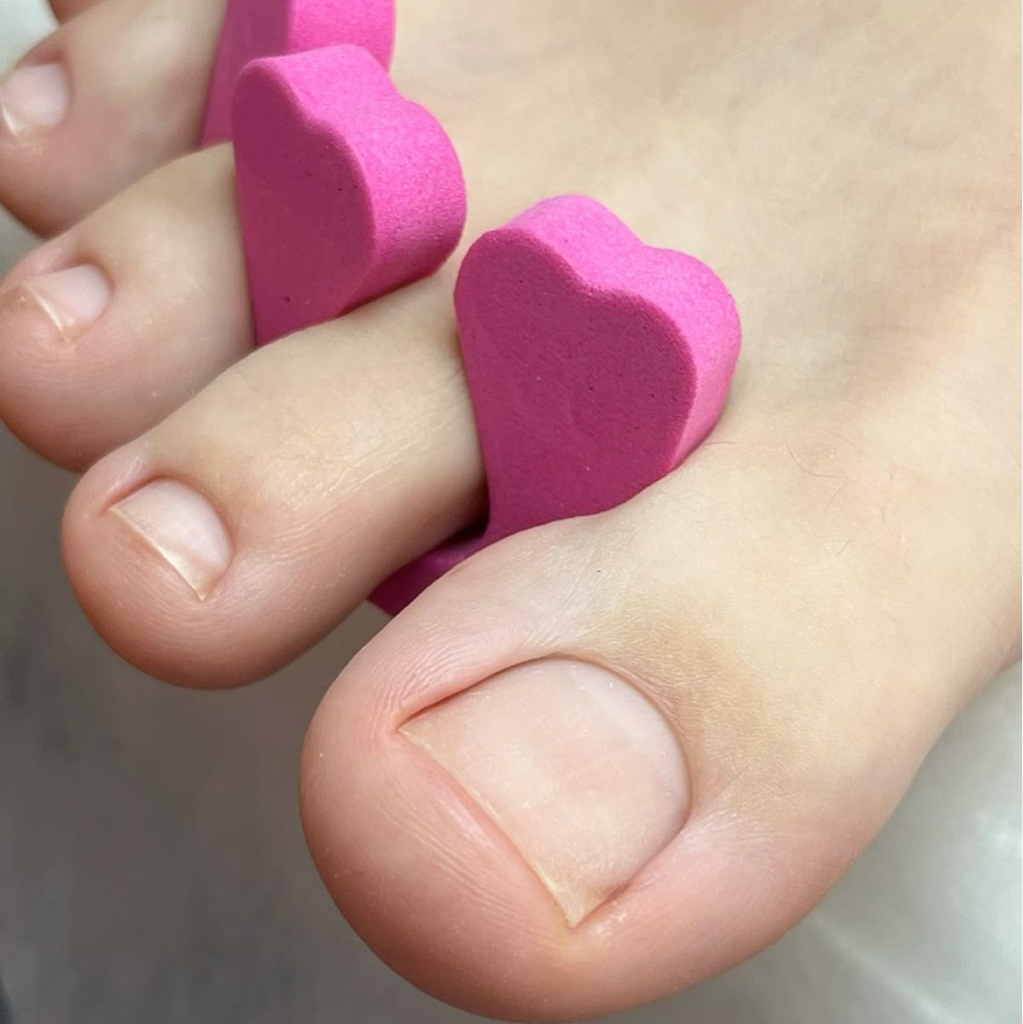 Покрытие лечебным лаком