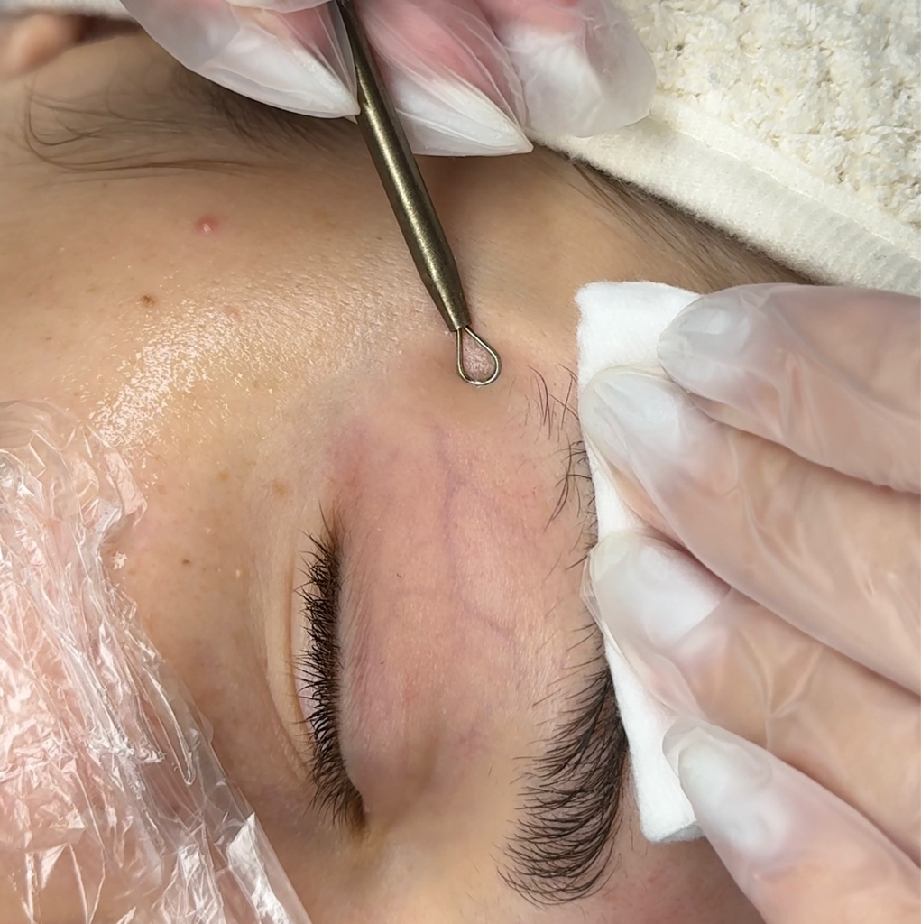 Механическая чистка лица + Orange peel MEDIDERMA