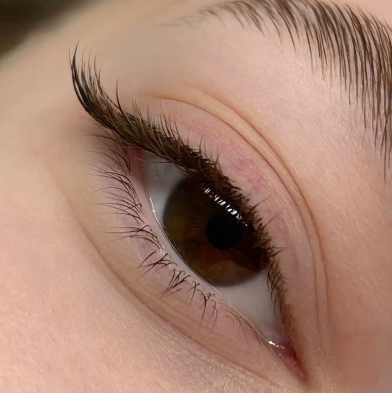 Уголки глаза