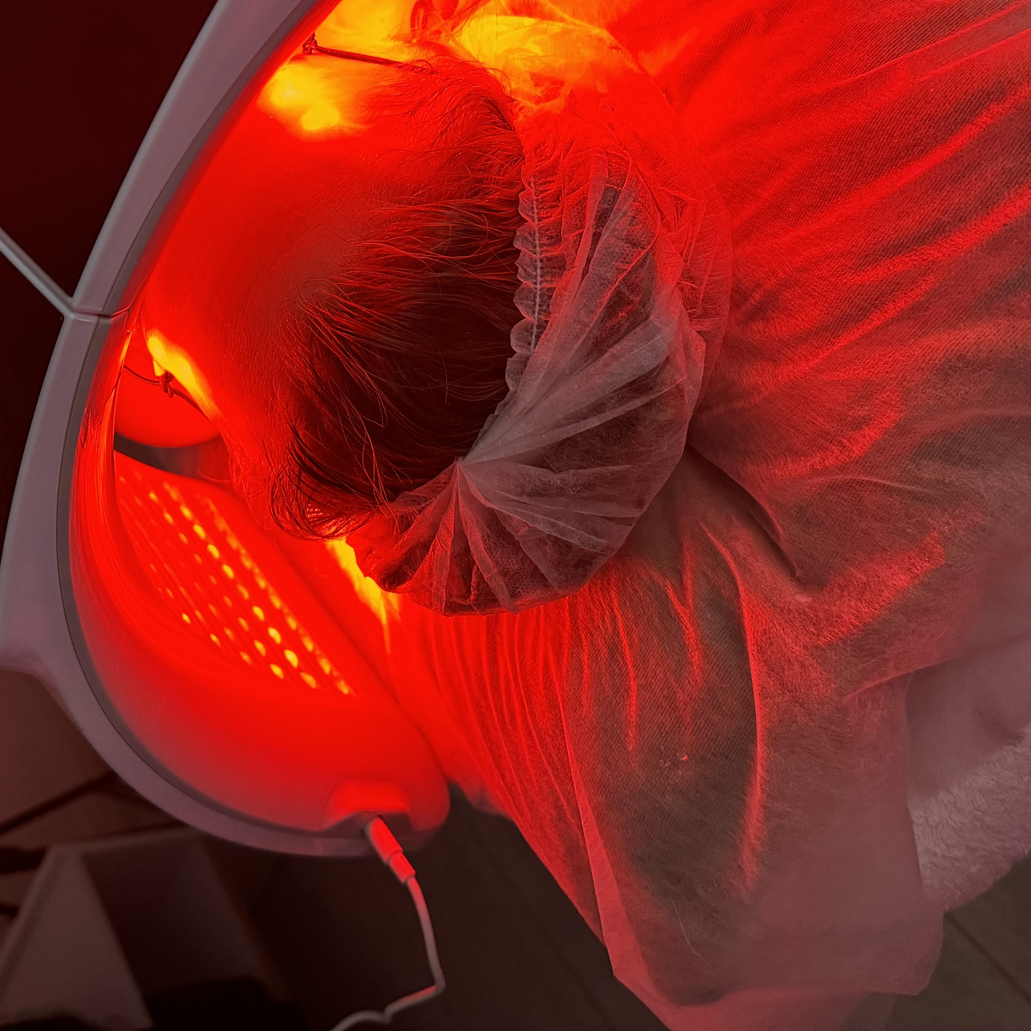 ФОТОДИНАМИЧЕСКАЯ ТЕРАПИЯ КОЖИ ПО ПРОБЛЕМЕ