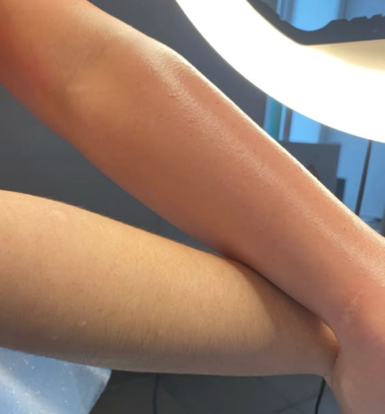 Руки полностью шугаринг