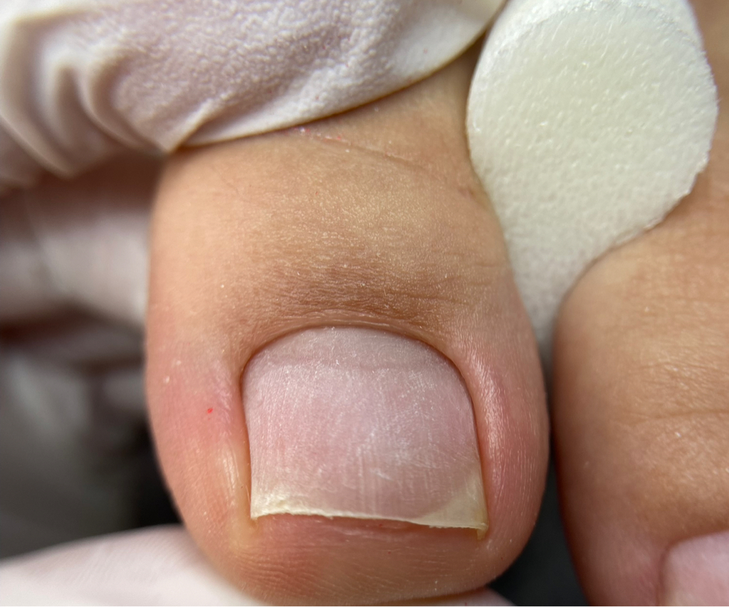 Педикюр пальчики без покрытия