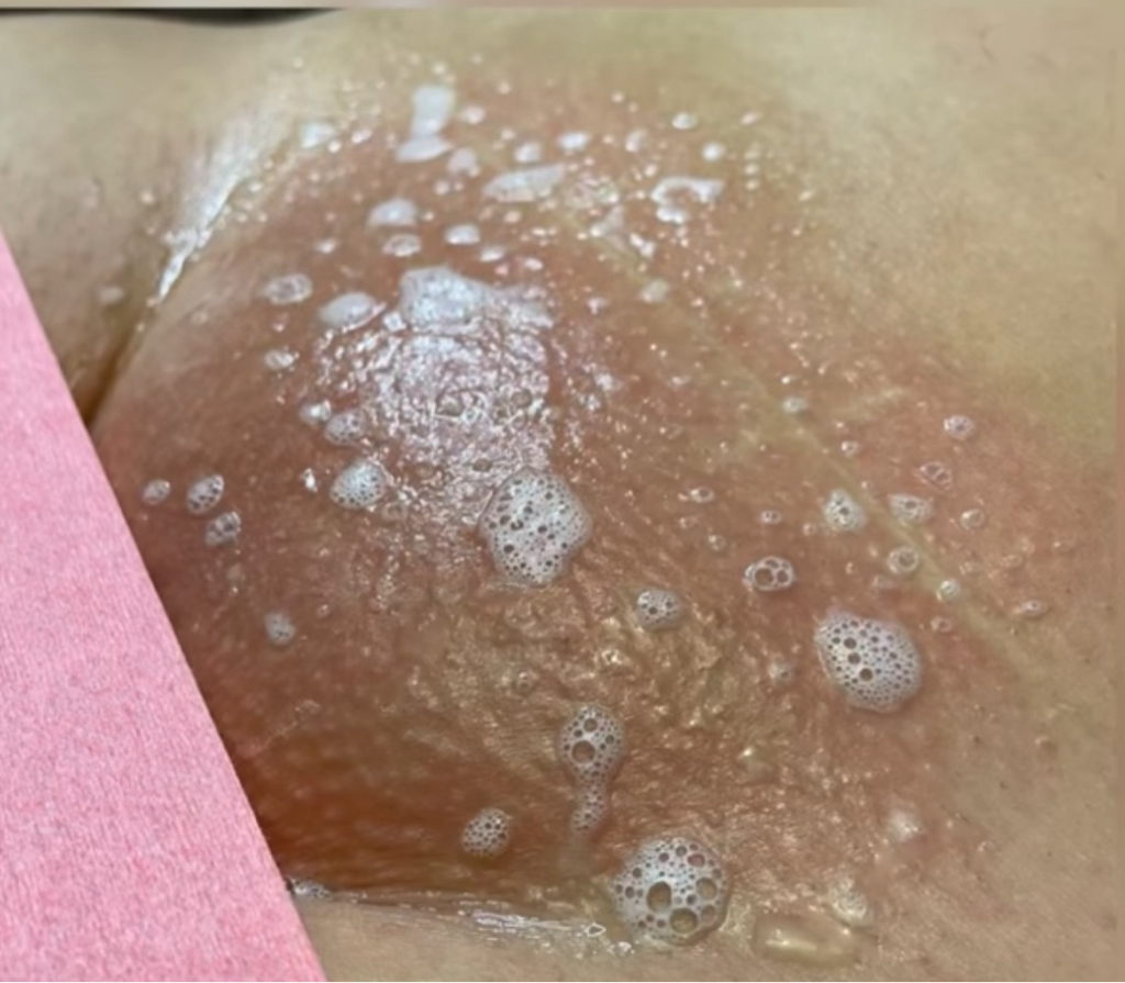 Бикини классическое шугаринг