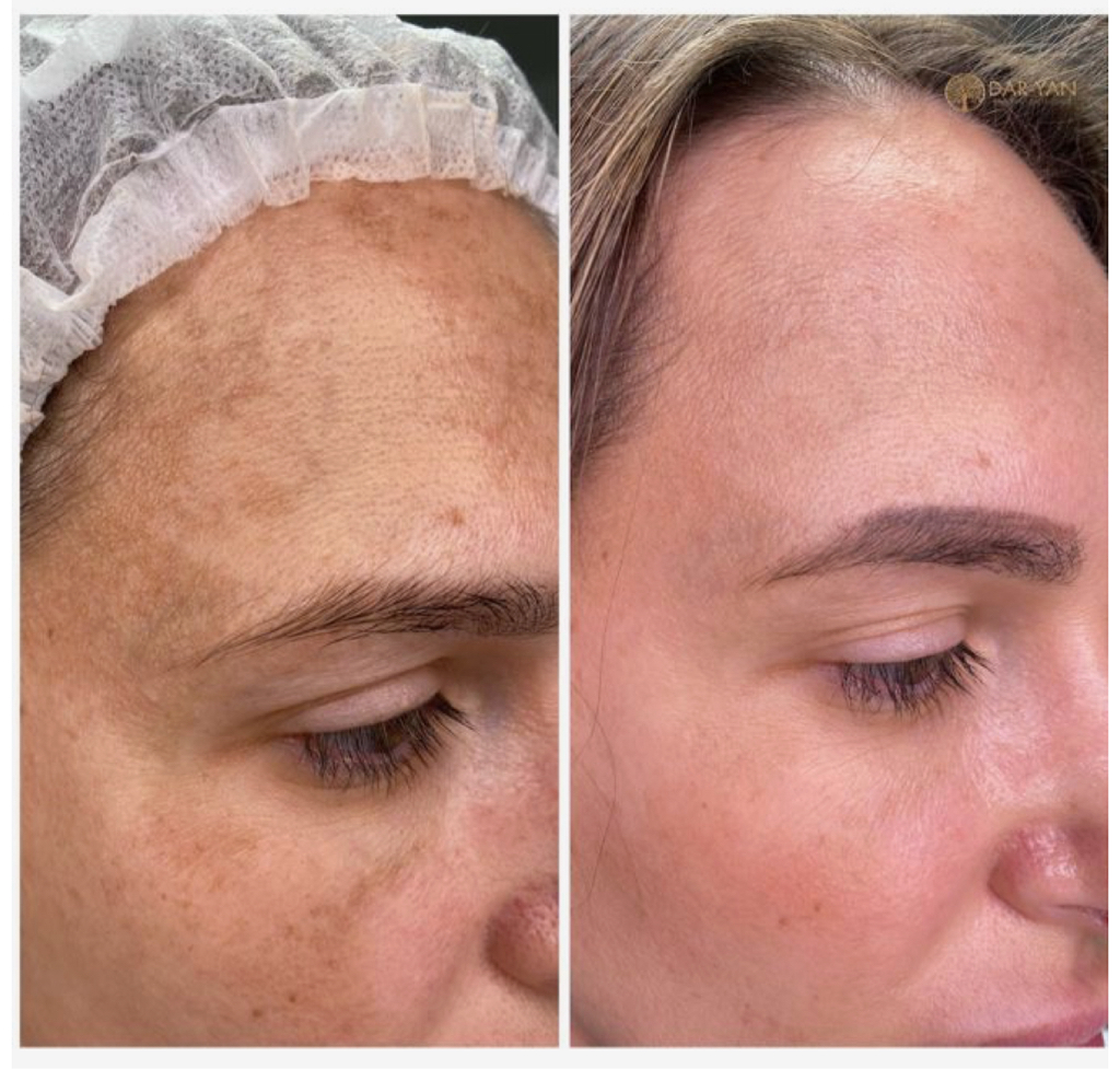 Косметический уход против пигментации