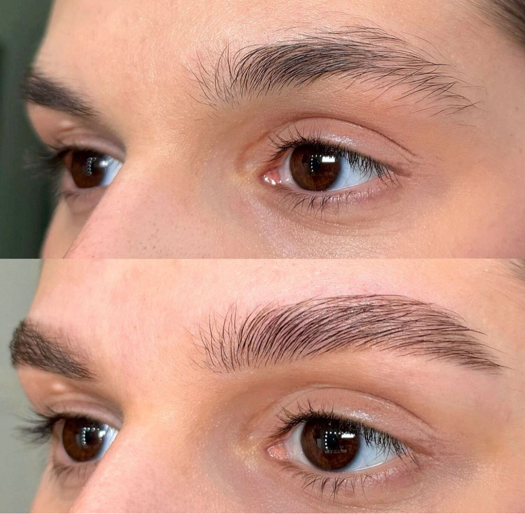 Прореживание