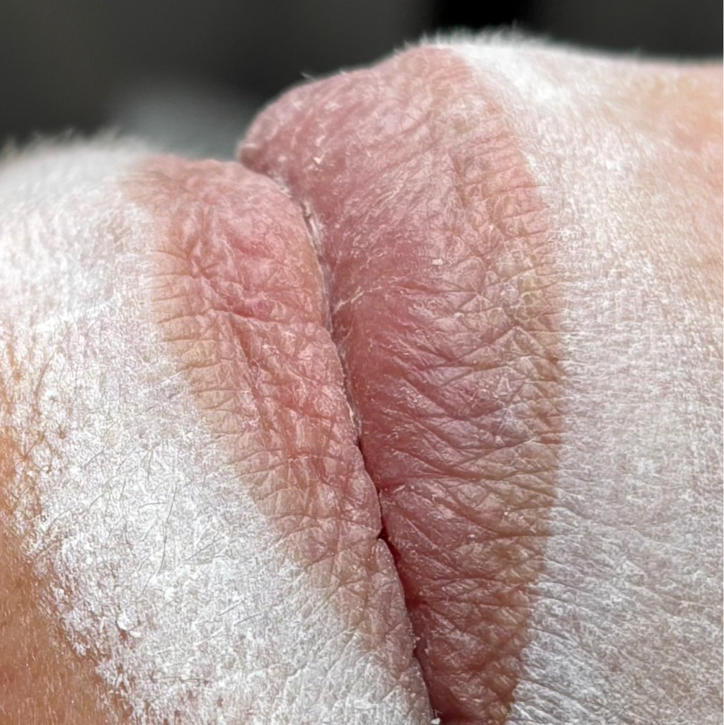 Перманентный макияж губ (2 этап) делается не позднее 2-х месяцев от 1 этапа