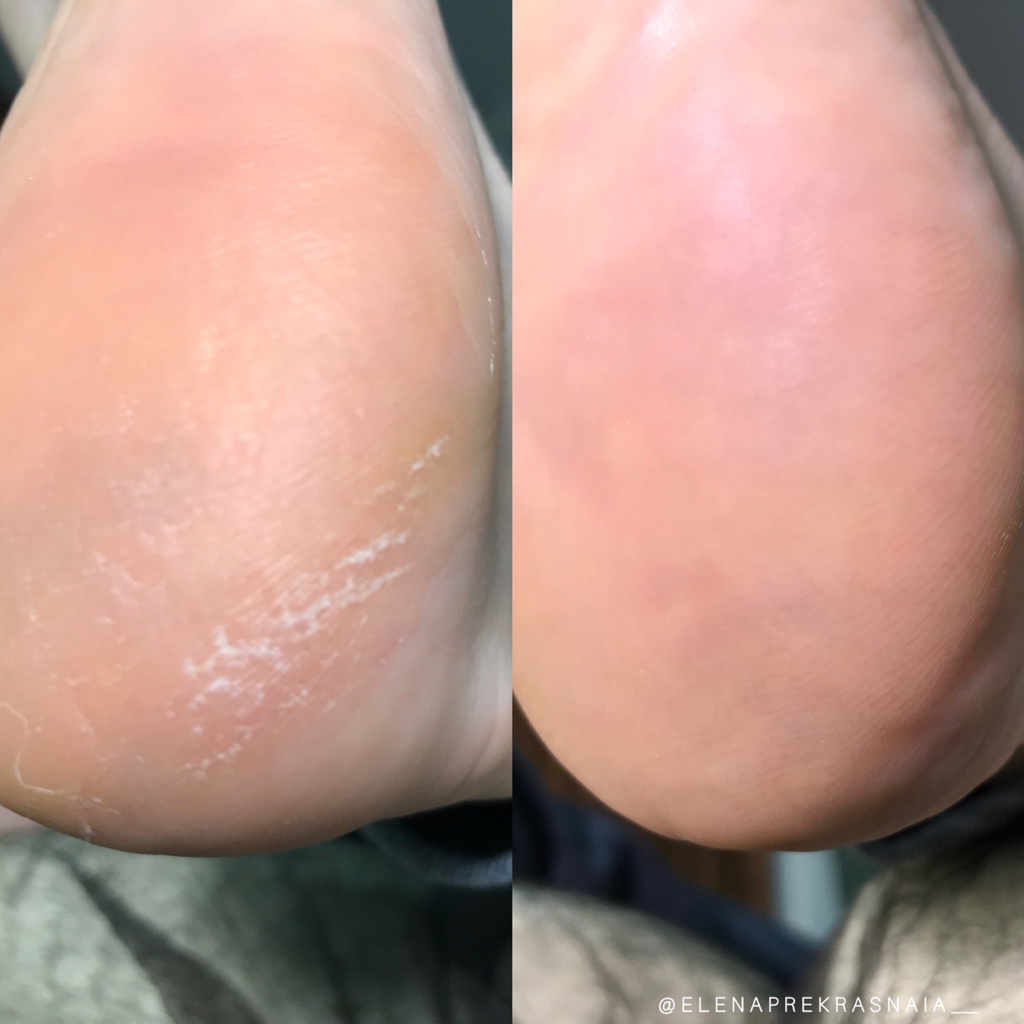 Педикюр Golden Trace/дисковой системой без покрытия