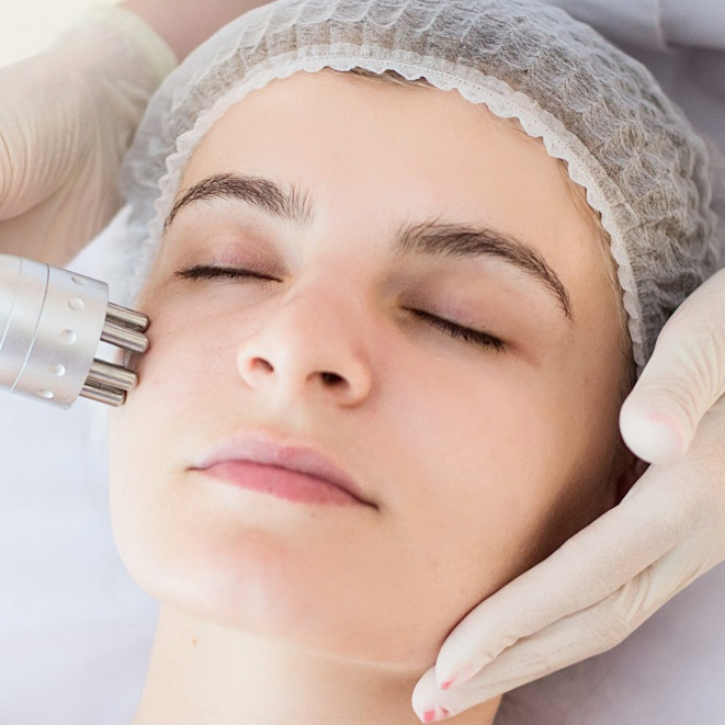 RF лифтинг лица