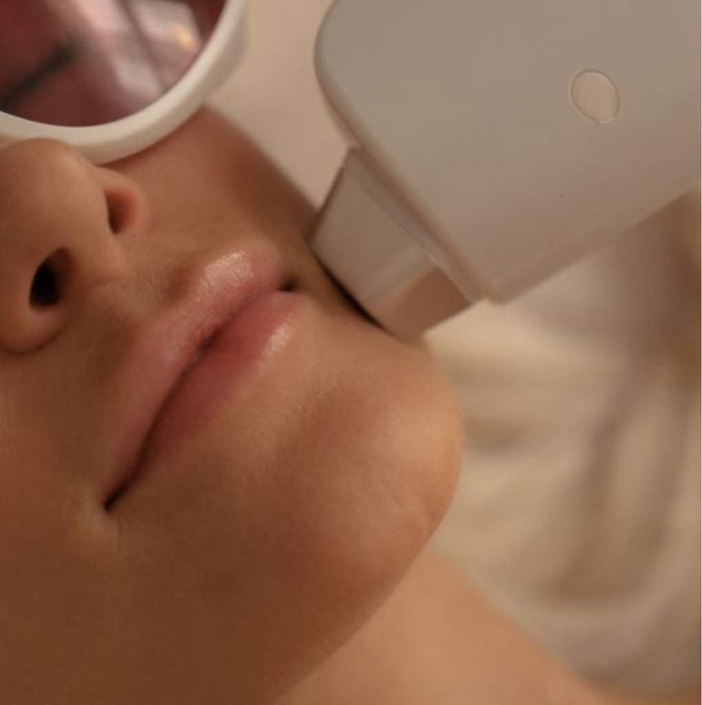 Лицо полностью эпиляция