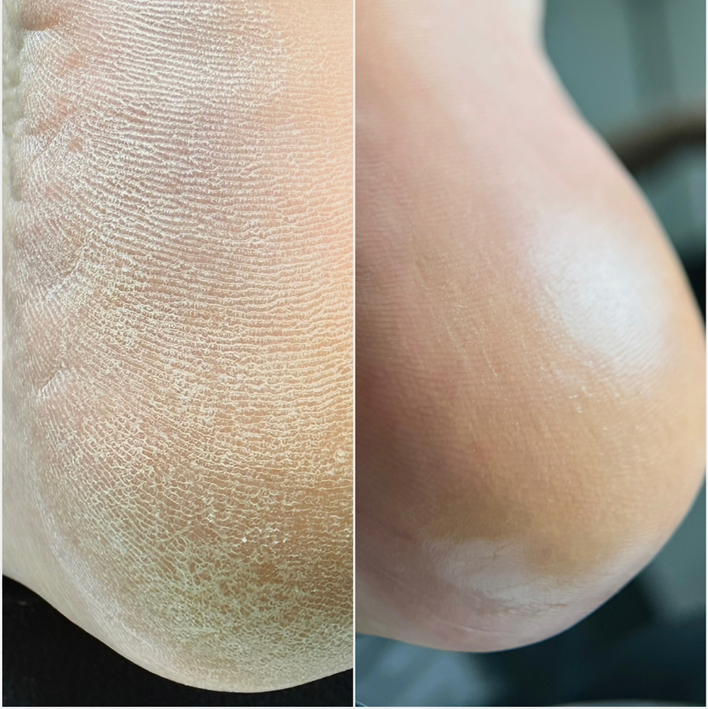 Аппаратный педикюр (полный комплекс) без покрытия