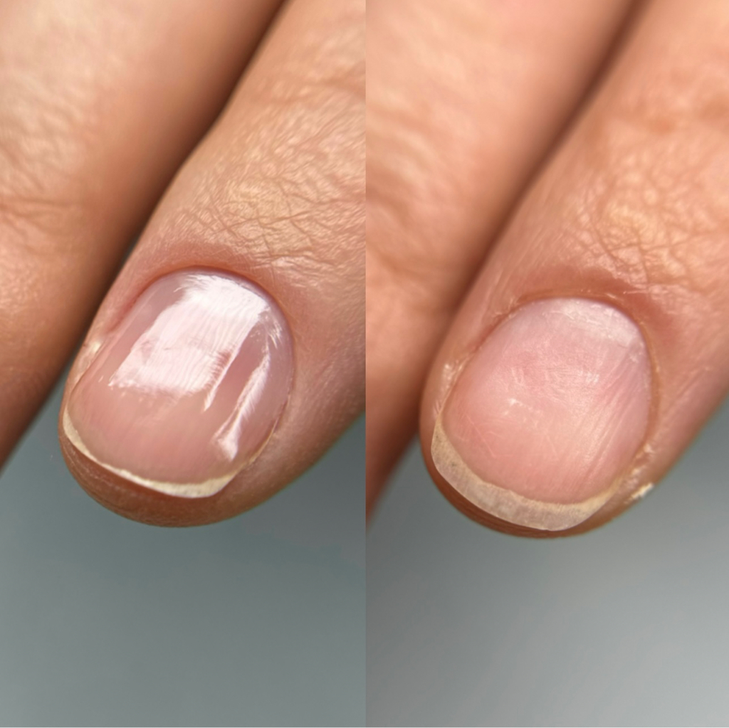 Гигиенический маникюр +  уход Straderm