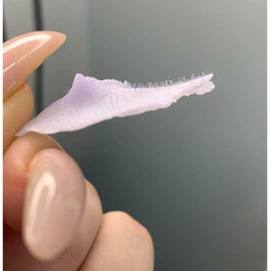 Удаление волос над верхней губой