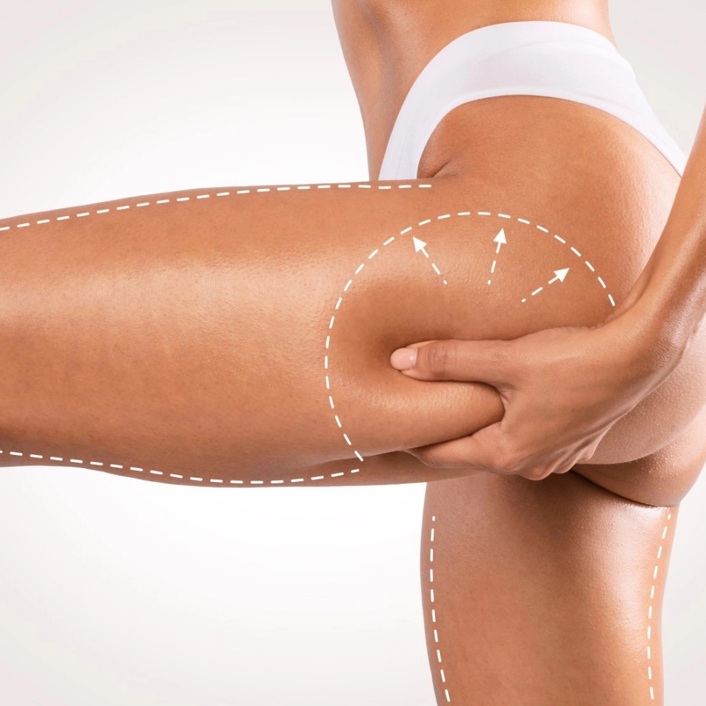 Программа "Бедра и Ягодицы"