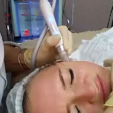 ГИДРОПИЛИНГ