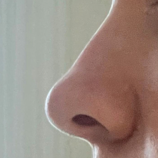 Удаление волос в носу