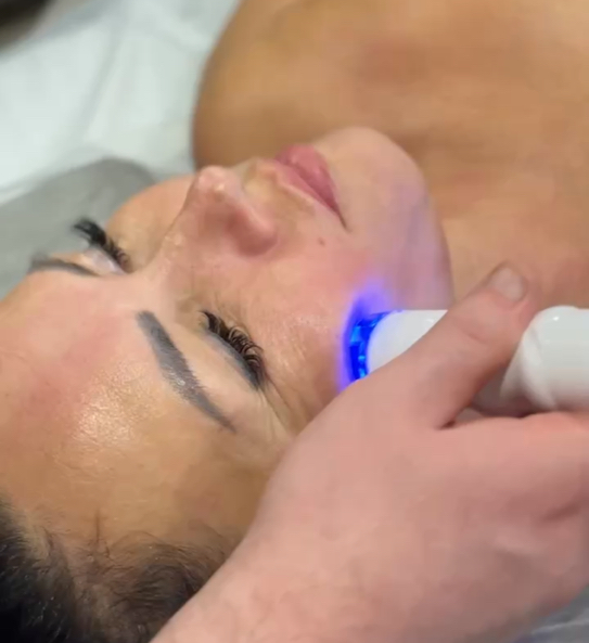 30мин RF-массаж лица