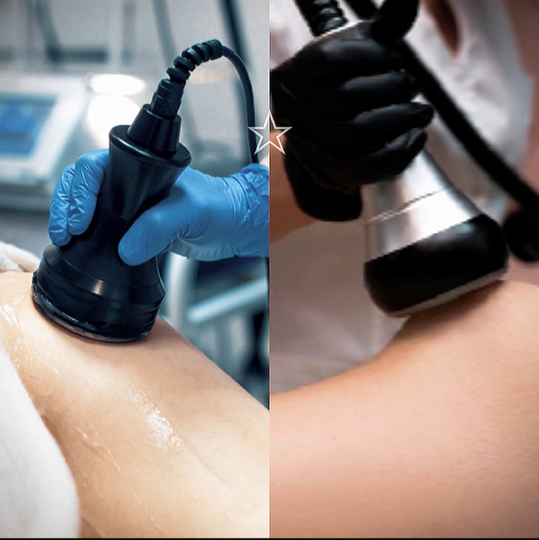 Кавитация + вакуумный RF